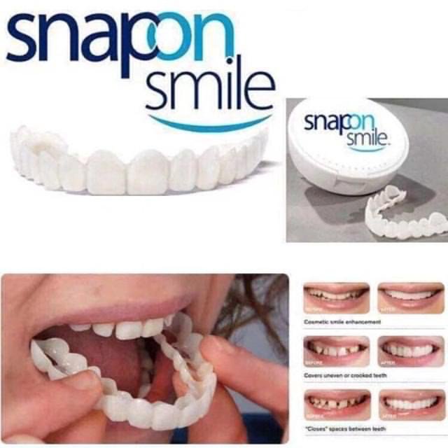 Белый/Виниры для зубов Snapon Smile (Белый)