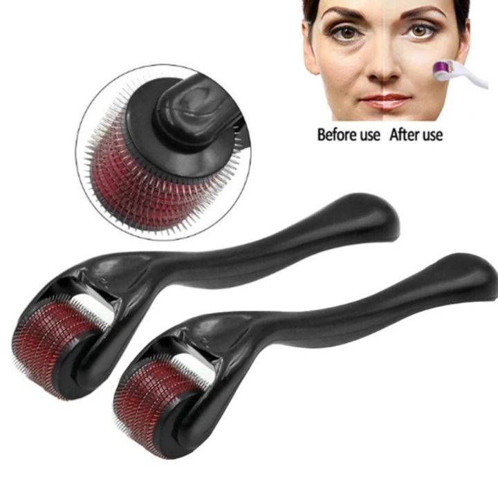 Мезороллер 0,3мм