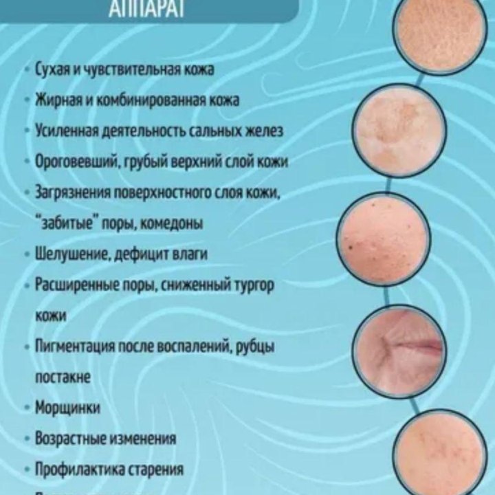 Аппарат для ультразвуковой чистки лица .