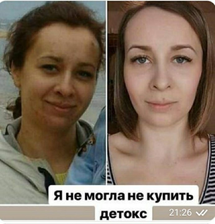 Icoon до и после реальные отзывы Неактивно