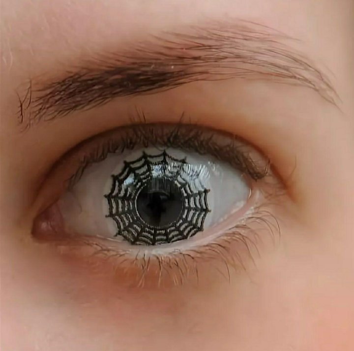 Линзы глаза дефект