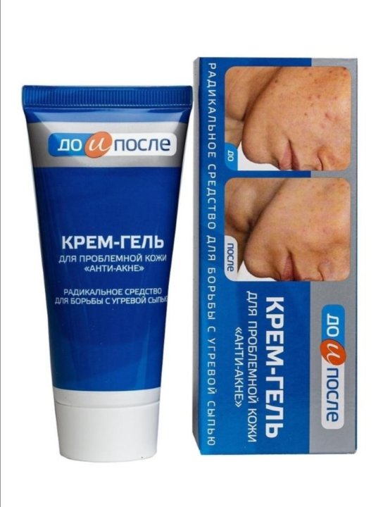 Лечебный макияж для проблемной кожи с La Roche- Posay Effaclar Duo(+) Unifant От