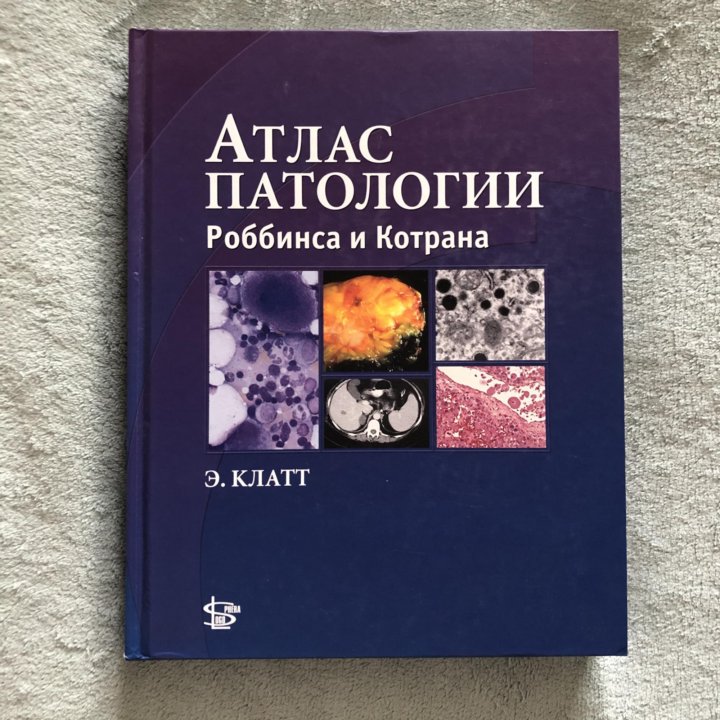 Атлас патологической анатомии зайратьянца. Патология по Роббинсу и Котрану. Основы патологии заболеваний по Роббинсу и Котрану. Учебник Роббинса и Котрана. Атлас патологии Роббинса и Котрана.