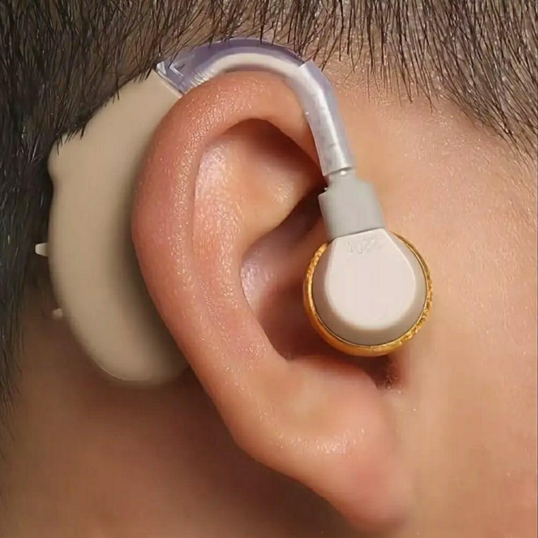 Качественные слуховые аппараты. Слуховой аппарат Axon hearing Aid v 185. Усилитель слуховой аппарат внутриушной. Слуховой аппарат цифровой заушный. Слуховой аппарат Helix hearing модель 02976.